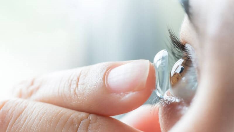 Loét giác mạc do nhiễm trùng thường gặp ở người dùng kính áp tròng