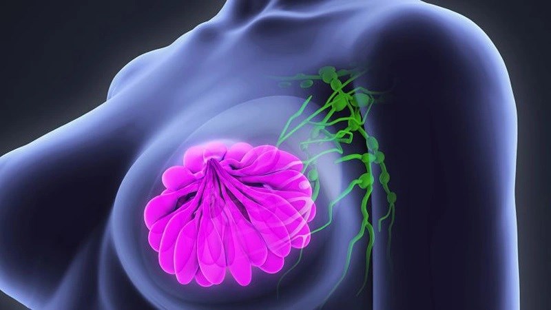 Sự suy giảm hormone ở thời kỳ mãn kinh làm tăng nguy cơ mắc ung thư vú