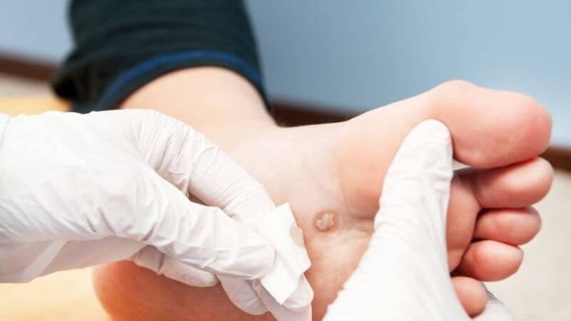 Khám da liễu để đánh giá mức độ và khả năng xâm lấn của tổn thương