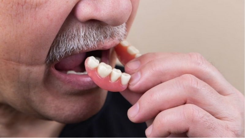 Đeo răng giả tạo môi trường thuận lợi cho các sinh vật Candida phát triển Đeo răng giả tạo môi trường thuận lợi cho các sinh vật Candida phát triển