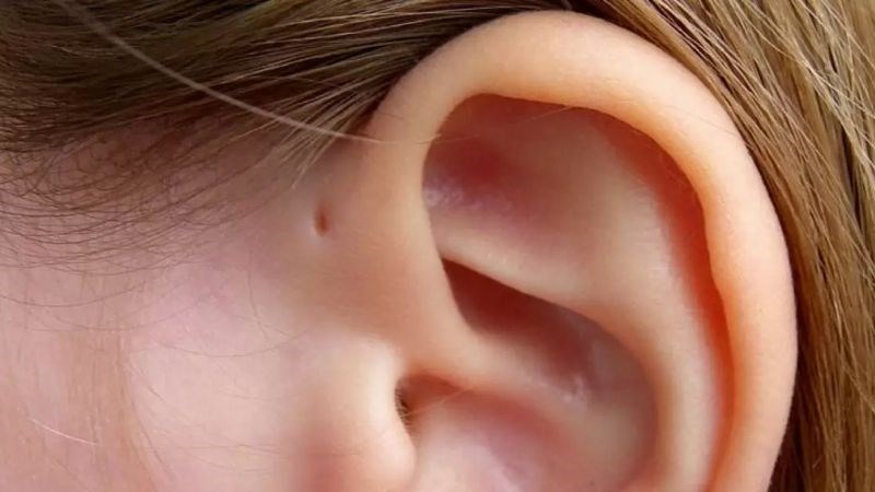 Lỗ rò luân nhĩ có kích thước khoảng bằng đầu cái tăm