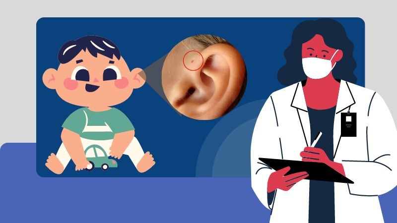 Chẩn đoán rò luân nhĩ chủ yếu dựa vào quan sát