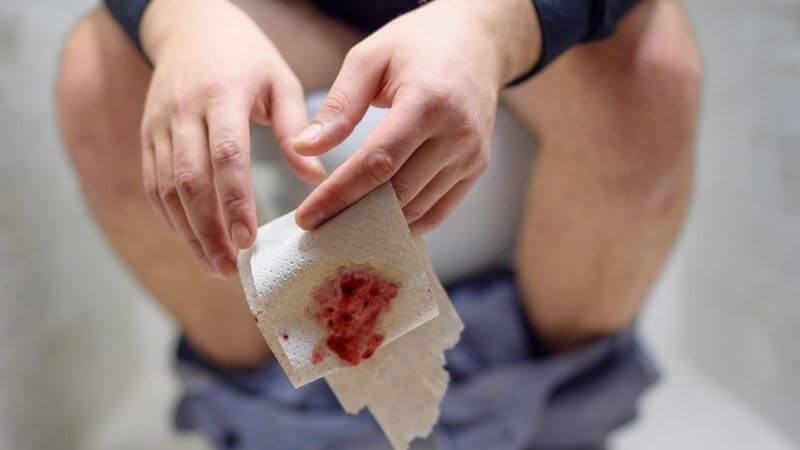 Bệnh nhân có thể gặp biến chứng chảy máu trực tràng Bệnh nhân có thể gặp biến chứng chảy máu trực tràng