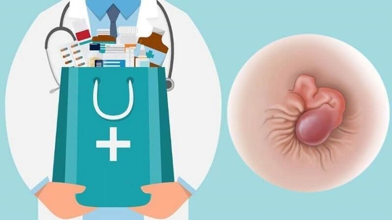 Sờ thấy khối lồi ngoài hậu môn là dấu hiệu cần đến gặp bác sĩ sớm Sờ thấy khối lồi ngoài hậu môn là dấu hiệu cần đến gặp bác sĩ sớm