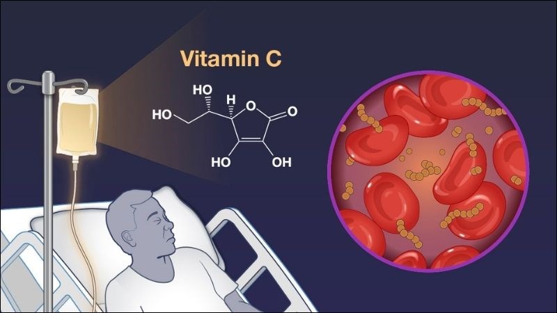 Bệnh scorbut là tình trạng cơ thể thiếu hụt vitamin C nghiêm trọng