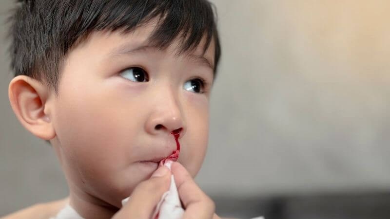 Thường xuyên chảy máu mũi là dấu hiệu cần gặp bác sĩ sớm