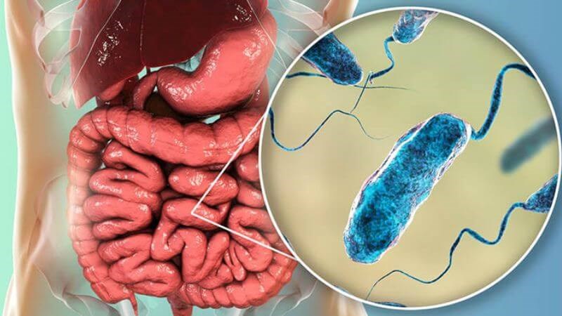 Bệnh tả là bệnh nhiễm khuẩn cấp tính tại ruột non gây ra do vi khuẩn Vibrio Cholerae Bệnh tả là bệnh nhiễm khuẩn cấp tính tại ruột non gây ra do vi khuẩn Vibrio Cholerae