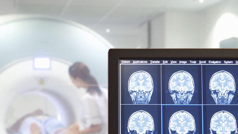 Chụp cộng hưởng từ (MRI) có thể chẩn đoán nguyên nhân gây bệnh