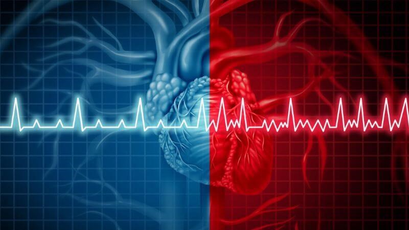 Thông liên nhĩ có thể dẫn đến biến chứng rối loạn nhịp tim