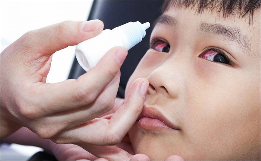 bệnh thường gặp ở trẻ mầm non sẽ có bệnh đau mắt đỏ
