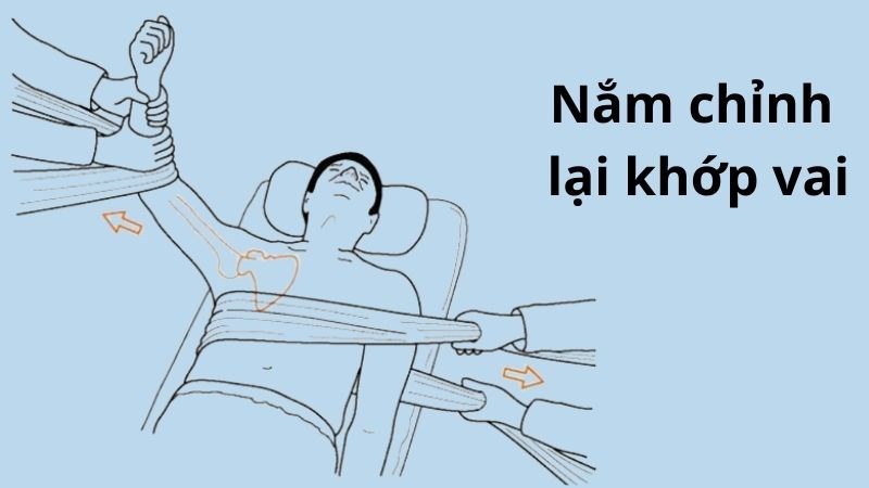 Cần phải đến các cơ sở y tế để nắn sai khớp vai Cần phải đến các cơ sở y tế để nắn sai khớp vai