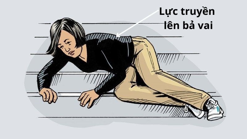 Ngã chống khuỷu có thể làm trật khớp vai Ngã chống khuỷu có thể làm trật khớp vai