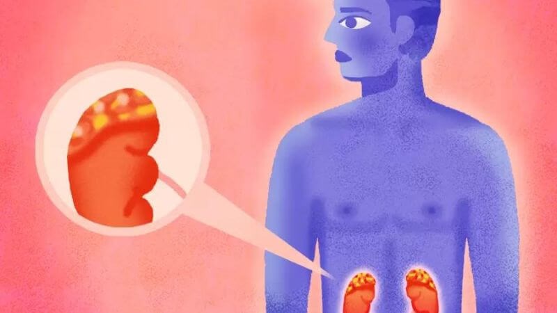 Các khối u nguyên bào thần kinh thường xuất hiện ở tuyến thượng thận Các khối u nguyên bào thần kinh thường xuất hiện ở tuyến thượng thận