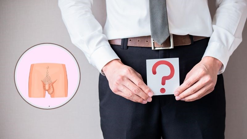 Tinh hoàn ẩn là một trong những yếu tố nguy cơ gây ra bệnh Tinh hoàn ẩn là một trong những yếu tố nguy cơ gây ra bệnh