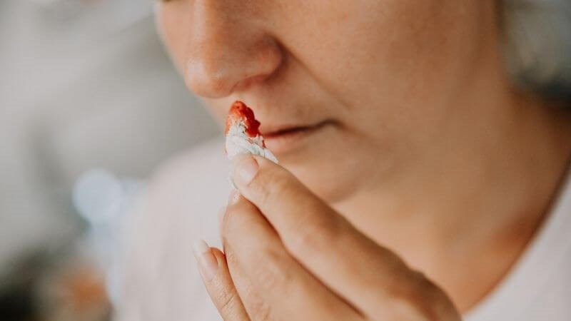 Chảy máu mũi là dấu hiệu cần đến gặp bác sĩ
