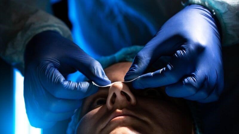 Phẫu thuật giúp điều trị triệt để lệch vách ngăn mũi