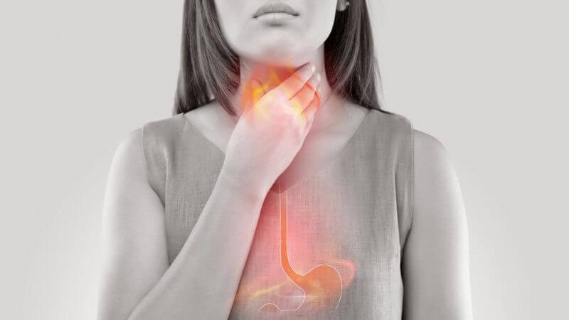 Trào ngược dạ dày thực quản là một trong những nguyên nhân gây bệnh