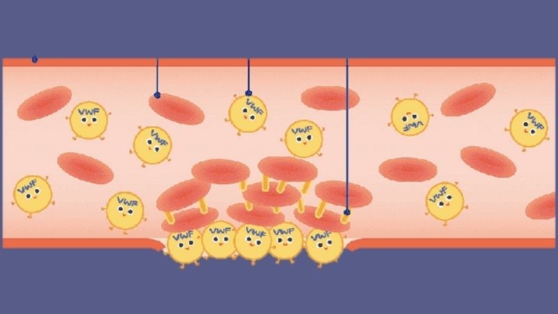 Bệnh von Willebrand là bệnh rối loạn đông cầm máu do di truyền