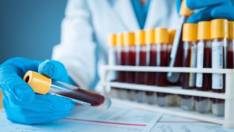 Xét nghiệm máu là xét nghiệm quan trọng nhất để chẩn đoán bệnh von Willebrand