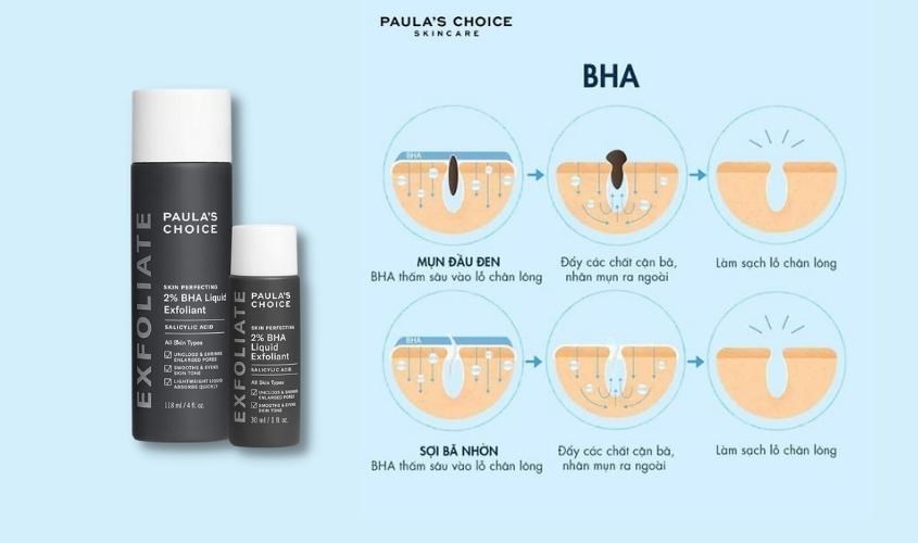 Quá trình đẩy nhân mụn của BHA