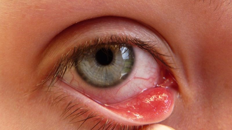 Các virus cảm cúm thông thường cũng có thể gây ra bệnh