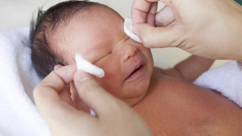 Viêm kết mạc ở trẻ em có thể khiến bé có nguy cơ  mắc các vấn đề về thị lực