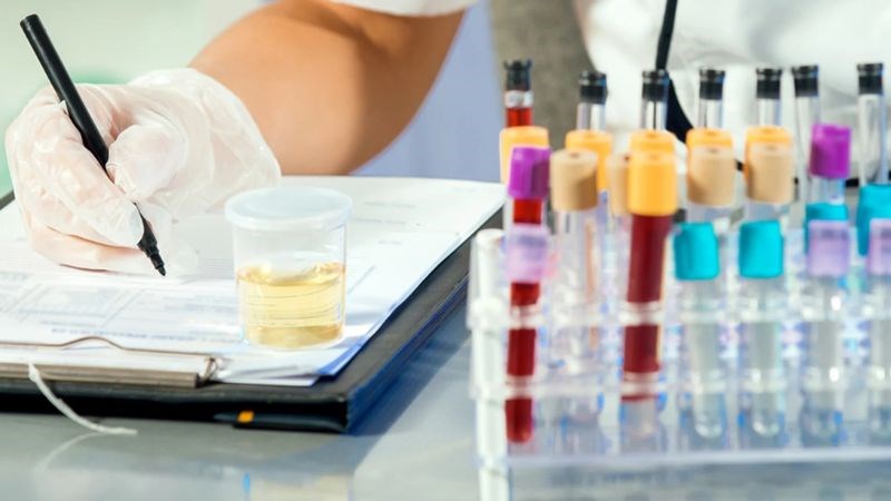 Phân tích nước tiểu là một xét nghiệm phổ biến nhằm kiểm tra, chẩn đoán và theo dõi tình trạng sức khỏe