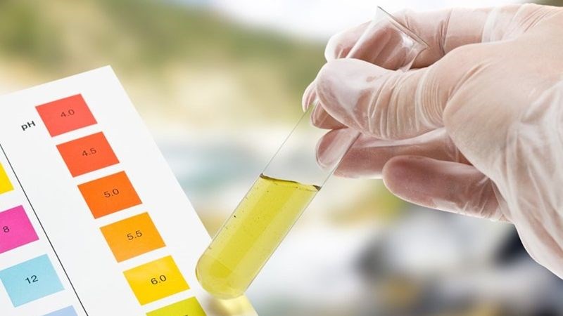 Độ pH cao cho thấy có các vấn đề về thận và nhiễm trùng đường tiết niệu 