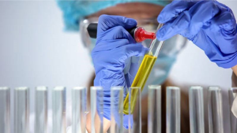 Kết quả BIL dương tính có thể do bệnh lý túi mật hoặc gan bị tổn thương