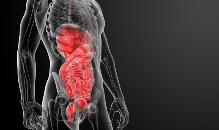 Rối loạn tiêu hóa không gây ra bởi những bệnh lý phổ biến