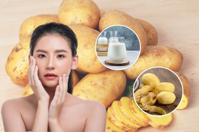 Cách chăm sóc da mặt bị sạm đen với khoai tây Cách chăm sóc da mặt bị sạm đen với khoai tây