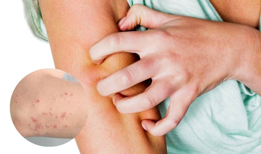 Dùng phải hàng giả có thể gây kích ứng và tổn thương sâu cho làn da