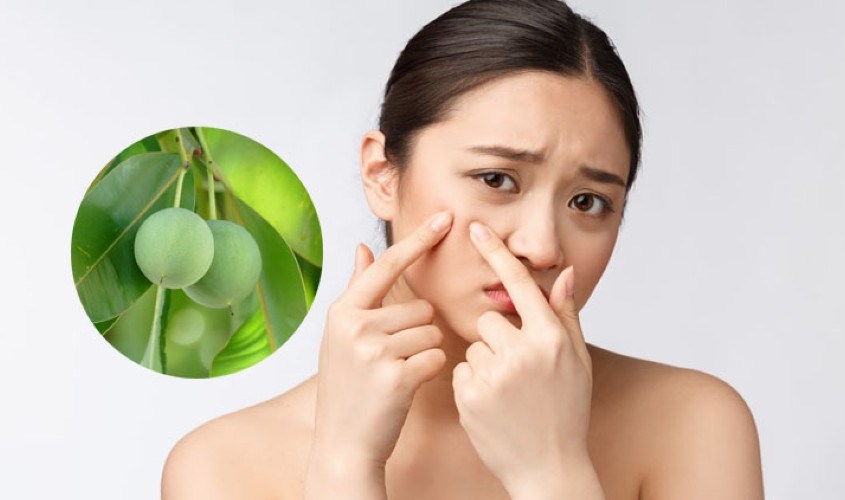 Dầu mù u có trị nám hiệu quả