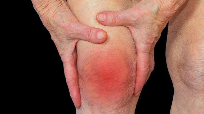 Bài thuốc chữa viêm khớp dạng thấp từ kê huyết đằng