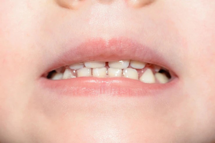 Thói quen vệ sinh răng tốt sẽ giúp trẻ có một hàm răng chắc khỏe. Ảnh: freepik Thói quen vệ sinh răng tốt sẽ giúp trẻ có một hàm răng chắc khỏe. Ảnh: freepik