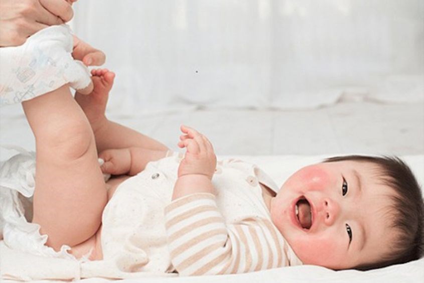 Hẹp bao quy đầu ở trẻ sơ sinh 