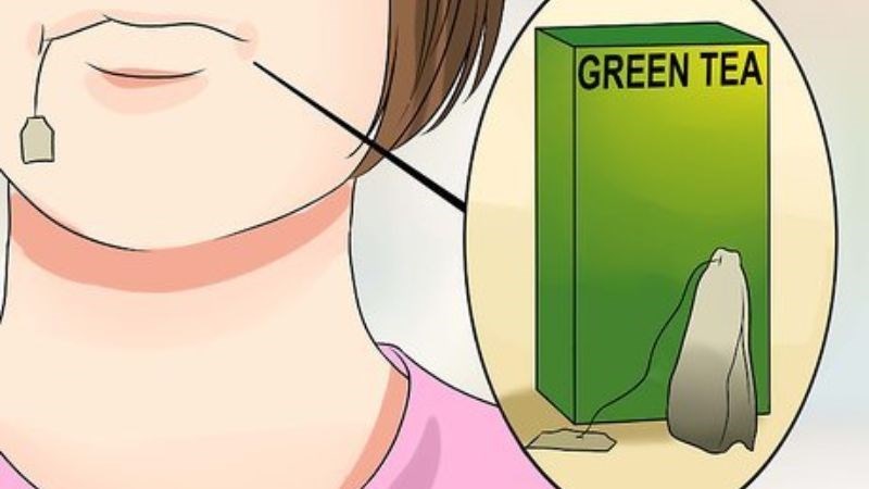 Đắp túi trà giúp giảm sưng và chống nhiễm trùng hiệu quả