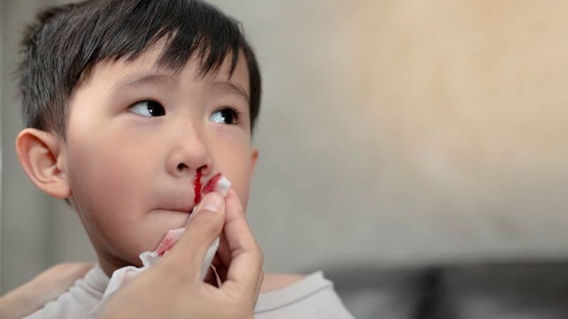 Chảy máu mũi kéo dài ở trẻ có thể do bệnh Hemophillia