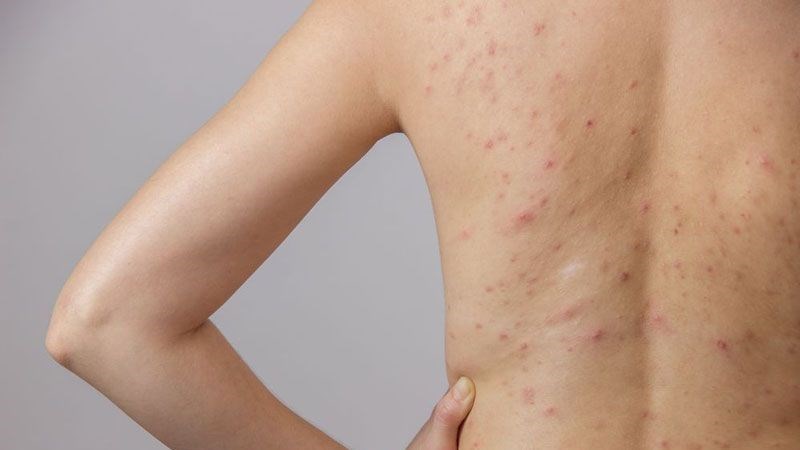 Hạt sen chứa flavonoid có tính kháng viêm