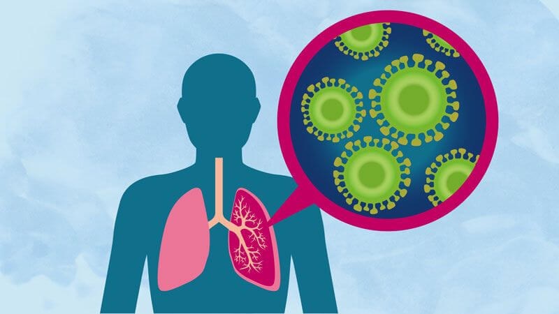 Viêm phổi là biến chứng thường gặp ở bệnh nhân hôn mê