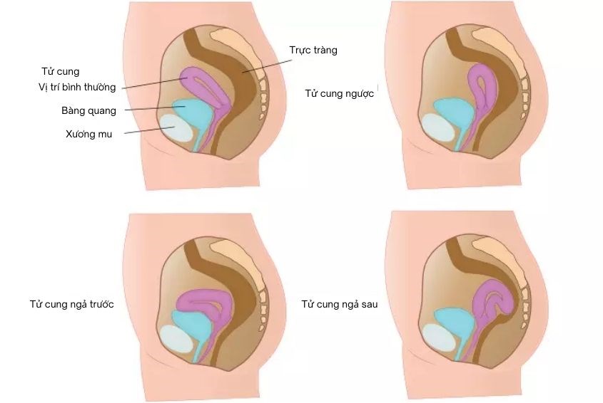 Kích thước và cách thức hoạt động của tử cung khi phụ nữ mang thai