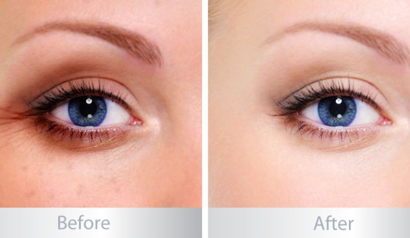 Hiệu quả sản phẩm trước và sau khi dùng