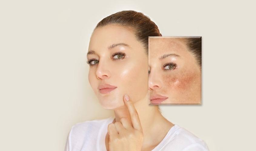 LHA giúp tái tạo và phục hồi da