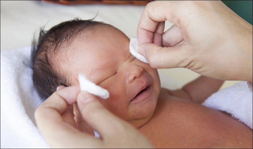 chườm ấm khi tắc tuyến lệ ở trẻ em