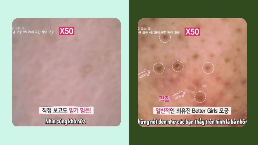 So sánh da của Lee Min Ju (trái) với người phụ nữ cùng tuổi (phải)