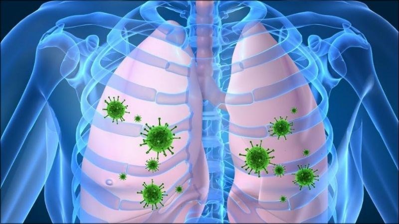 Các vi khuẩn gây ra bệnh viêm phổi khá đa dạng