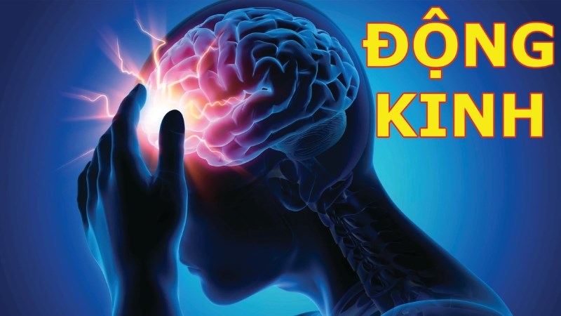 Cứ 26 người thì có 1 người động kinh