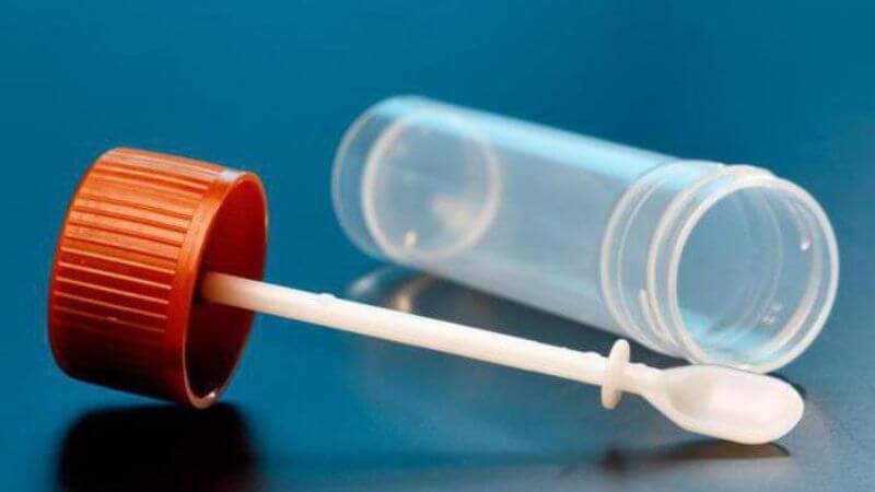 Soi phân tươi có thể giúp bác sĩ chẩn đoán nhiễm ấu trùng trong đường ruột