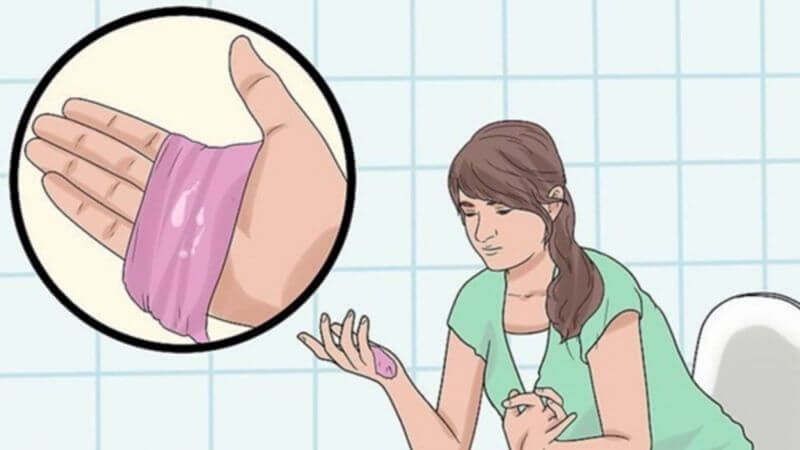 Người bệnh nên đến khám bác sĩ sớm nếu có những biến đổi màu sắc khí hư