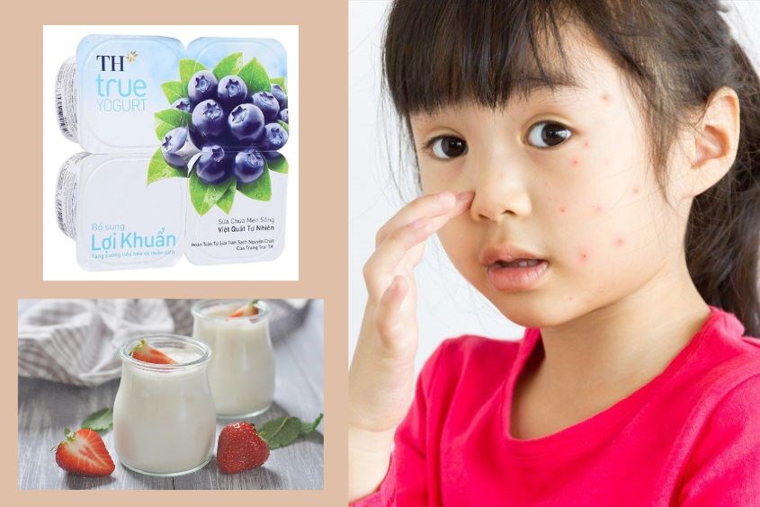 Sốt xuất huyết nên ăn gì